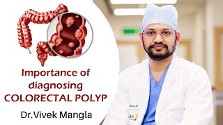 Colorectal polyps What are they and whats their link to colorectal cancer [upl. by Arabele285]