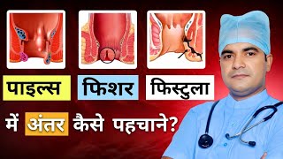 piles fissure fistula mein kya antar hai  piles fissure fistula  piles fissure fistula difference [upl. by Meridith]