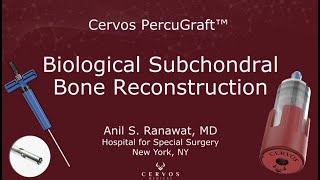 Biological Subchondral Bone Reconstitution by Dr Ranawat [upl. by Bridge]