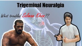 Trigeminal Neuralgia  Treatment options and explanation by Dr Skanda Neurosurgeon Salman Khan [upl. by Ynehpets341]