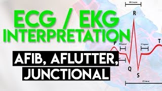 Afib Aflutter Junctional Arrhythmias  ECG EKG Interpretation Part 4 [upl. by Parks633]