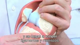 Lesiones de menisco o ligamentos de rodilla [upl. by Kenward]