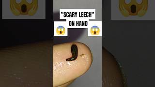 Scary Leech on hand shorts leech insects worms scaryanimal [upl. by Thecla266]