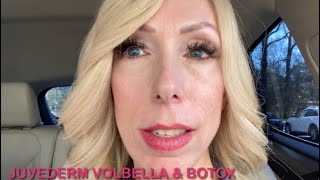 MY EXPERIENCE WITH JUVEDERM VOLBELLA AND BOTOX  Lip Filler [upl. by Oiuqise]