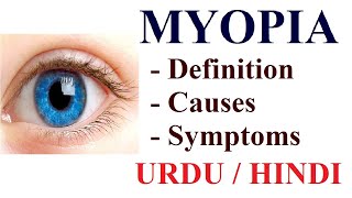 What is Myopia Near or Short sightedness  Causes Symptoms Treatment  Urdu  Hindi [upl. by Sirroned]