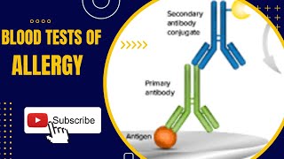 Blood Tests for Allergy RAST ELISA Pharmacognosy in Urdu Pharmacy Technicians part 1 [upl. by Sheri]