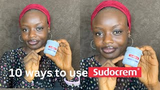 10 WAYS TO USE SUDOCREM Heal Eczema  Acne in 3days [upl. by Sarena]