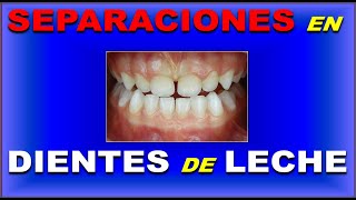 ESPACIOS INTERDENTALES EN DENTICION TEMPORAL  PRIMATES LEEWAY SPACE NANCE DERIVA INTERINCISALES [upl. by Motteo]