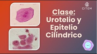 UROTELIO y EPITELIO CILÍNDRICO  En el examen de sedimento urinario [upl. by Salba]