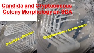 Candida and Cryptococcus colony morphology on SDA [upl. by Kory]