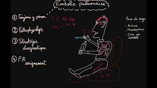 Embolie pulmonaire  Prise en charge  Partie 2  Docteur Synapse [upl. by Ahsemed]