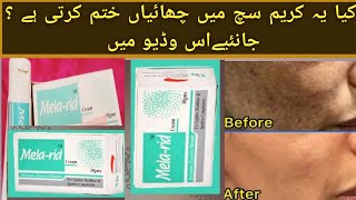 Mela rid cream review For Melasma pigmentation skin lightening  Honest Reviews Info [upl. by Aicilaana]