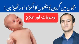 Torticollis in Babies Causes Symptoms and Treatment Options Explained  urdu amp hindi [upl. by Asseneg]