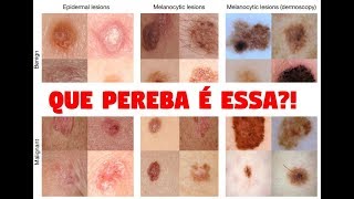 Dermatologia lesões elementares  Stanford Medicine 25 legendadotraduzido [upl. by Yehc627]