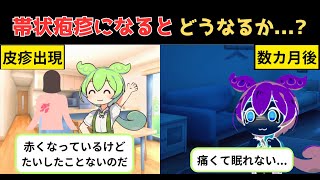 帯状疱疹になるとどうなるのか？症状や治療、予防について解説 【ずんだもん 医療 解説】 [upl. by Airbas964]