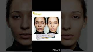 Eliteglo cream ke fayde short video health care hub [upl. by Lauree]