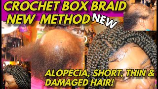 NEW CROCHET BOX BRAIDS DETAILED METHOD FOR ALOPECIA HAIR LOSS THIN amp DAMAGED HAIR [upl. by Burgwell]