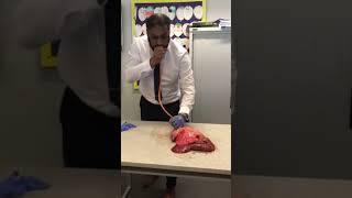 Lung inflation in Science Lesson science teacher biology shorts [upl. by Garreth]