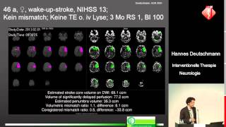 Interventionelle Therapie bei akuter neurologischer Symptomatik  Hannes Deutschmann [upl. by Bank]