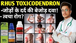 Rhus Tox 200 Homeopathic Medicine uses  Rhus Toxicodendron 30 uses in Hindi [upl. by Llewen]