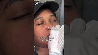 Dealing with nose piercing bumps✨ See how Base Laboratories Piercing Bump Treatment works [upl. by Aneek]