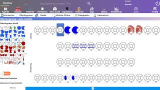 Cargar Odontograma de un paciente [upl. by Aromat]
