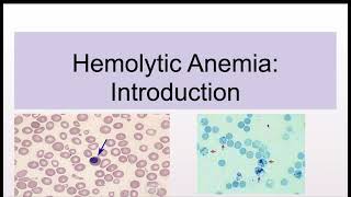 Hemolytic Anemias Introduction and Classification [upl. by Ramad]