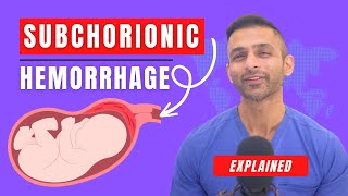 Subchorionic Hemorrhage Explained  Causes amp Treatment womenshealth miscarriage pregnancy [upl. by Ahsienek730]