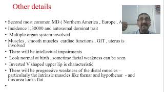 Muscular Dystrophy  Myotonic Dystrophy  Part 10 [upl. by Nad]