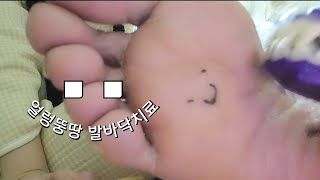 ASMR 발바닥치료  안마  물리치료  이빨요정의 각질제거까지👻 [upl. by Witcher]