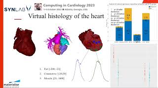 Advancing assessment and diagnostic with the use of virtual histology  PAOLO GARGIULO [upl. by Nwahsauq]