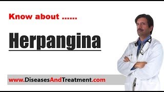 Herpangina  Causes Diagnosis Symptoms Treatment [upl. by Rozalin]