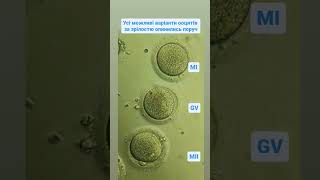 Human oocytes by maturity immature MI germinal vesicle GV mature MII Яйцеклітини людини [upl. by Agni]