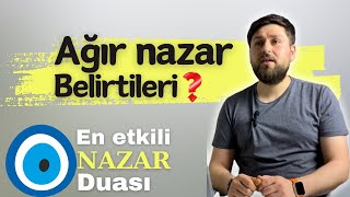 Ağır nazar belirtileri  En etkili nazar duası dua allah zikir ayet dinihikayeler [upl. by Conger209]