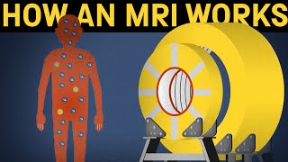 How does an MRI machine work [upl. by Annovoj331]