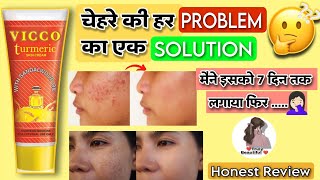 MUST WATCH BEFORE BUYING  Vicco Turmeric Ayurvedic Skin Cream Complete Review  Good For Skin [upl. by Ennove213]