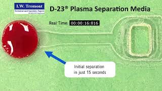 D23® Plasma Separator Media  IW Tremont [upl. by Uah]