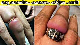 10 Most Unlucky People In The World  Malayalam [upl. by Gentilis]