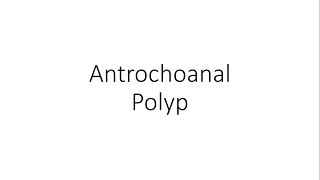 Antrochoanal Nasal Polyp  ENT [upl. by Yantruoc216]