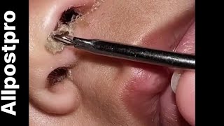 Cleaning baby nose 😍 Super satisfying [upl. by Mosnar]