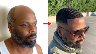 BALD TO 360 WAVES  Man Weave Transformation [upl. by Masry]