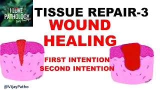 Wound Repair  MOA Animation [upl. by Atinnor548]