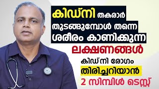 കിഡ്നി തകരാർ തുടങ്ങുമ്പോൾ തന്നെ ശരീരം കാണിക്കുന്ന ലക്ഷണങ്ങൾ  Kidney Disease Malayalam [upl. by Iturhs]