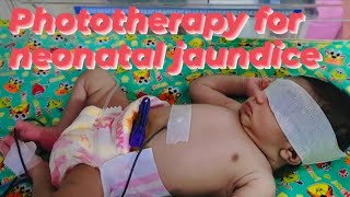 Phototherapy for neonatal jaundicePhototherapy treatment in NICUviral babytrendingnicu [upl. by Uolymme]