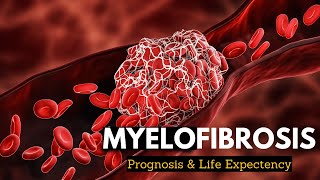 Myelofibrosis Explained What You Need to Know [upl. by Laith]