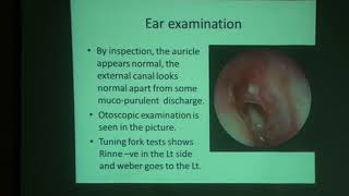 Case Scenario CSOM  ENT  4th grade  by Dr Hamza Elshafiey Ahmed [upl. by Broeder]