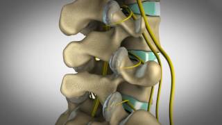 Orlando Chiropractic  Custom 3D animation visualizing facet syndrome and how chiropractic can help [upl. by Airaet977]