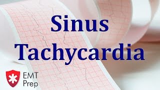 Sinus Tachycardia ECG  EMTprepcom [upl. by Ellinad]