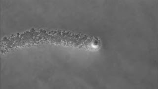 Staphylococcus aureus moves in “comets” [upl. by Htrahddis]