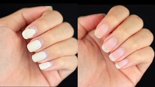 How to Remove Gel Nails at Home DamageFree [upl. by Lubeck]